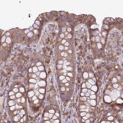 MOCS3 Antibody, Novus Biologicals:Antibodies:Primary Antibodies